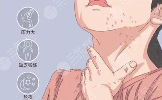 脖子上长痘