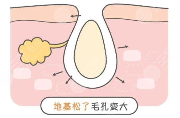 怎么收缩面部毛孔有又快速？文中3中方法你得学起来！如何预防是关键！
