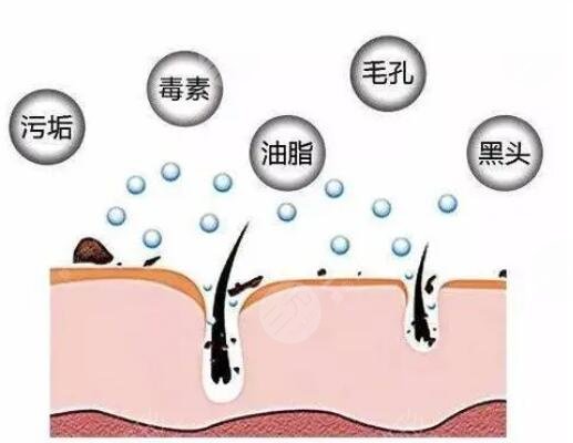 怎么收缩面部毛孔有又快速？