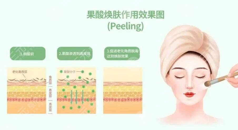 日常祛痘方法