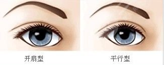 双眼皮手术术前要准备什么?
