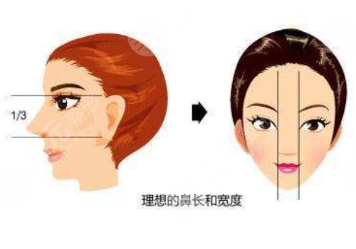 整个鼻子要花多少钱