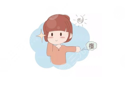 激光祛痘痘多少钱一次?