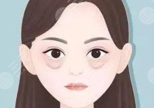 去眼袋皱纹副作用介绍
