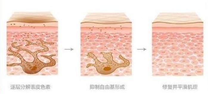 色素沉淀