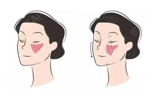 玻尿酸有什么用?作用与功盘点