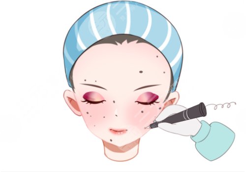 点痣后的注意事项有哪些？