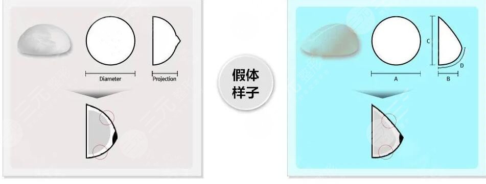 麦格假体好吗？