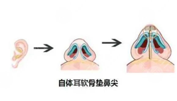 鼻尖