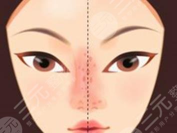 鼻尖