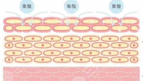 果酸嫩故