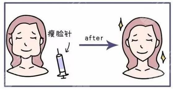 咬肌大怎么办怎么改善快速又有？怎么判断自己咬肌是否过大？