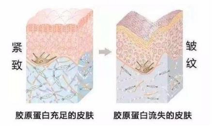 胶原蛋白