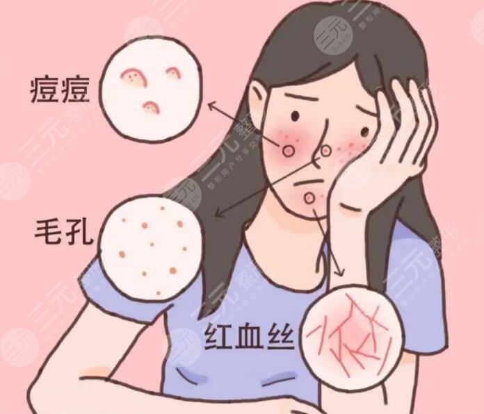 e光祛斑果怎样？价格多少钱一次？注意事项等你关心的问题这里都有答案~