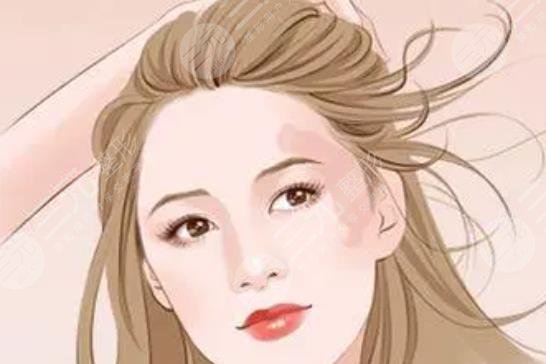 胎记