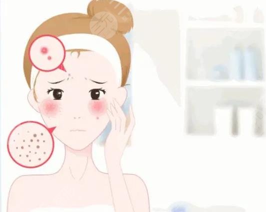 油性皮肤