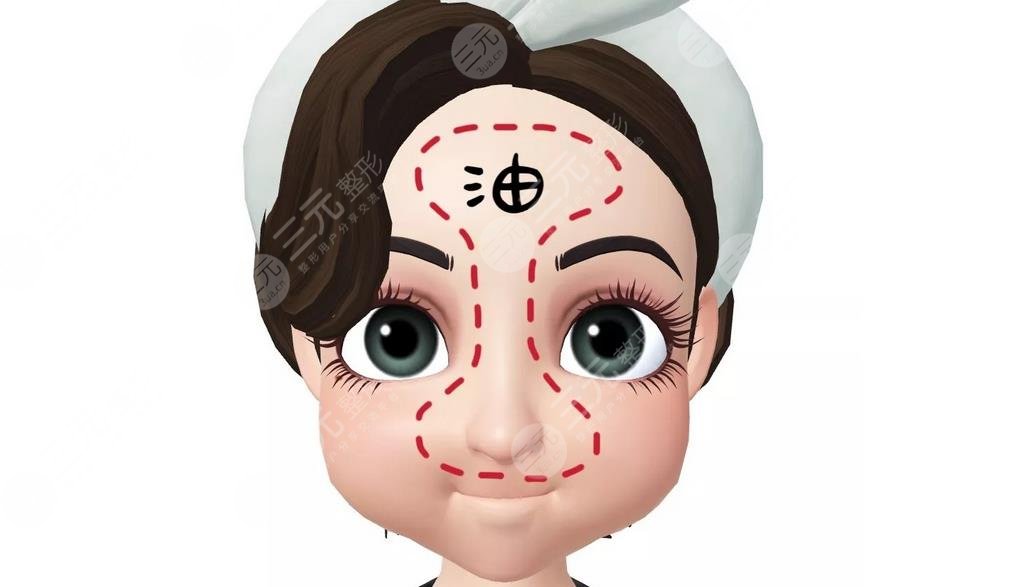 油性皮肤