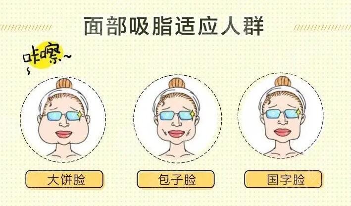 面部吸脂果好吗怎么样？面部吸脂手术原理及真实果解析，戳中了你吗？
