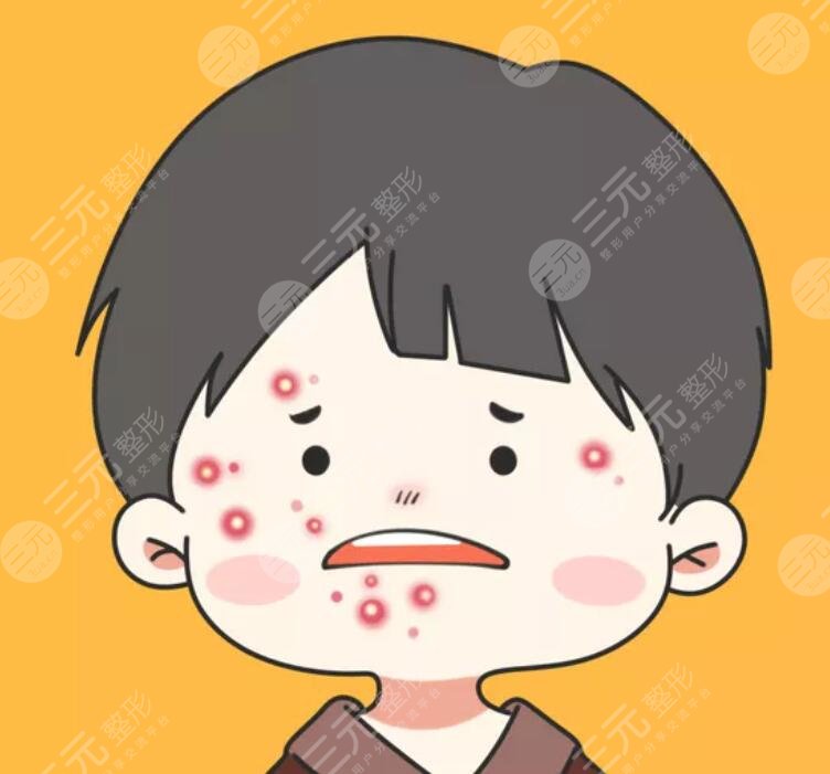 光子嫩肤祛痘做几次才有果？