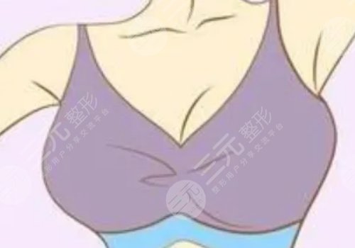 .威宁之星假体隆胸价格多少?