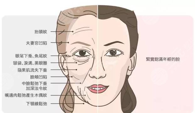 怎样减少眼部皱纹