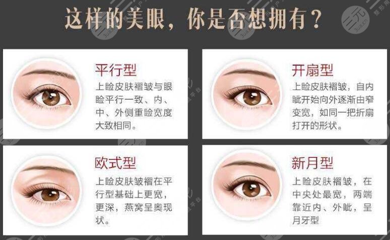 双眼皮