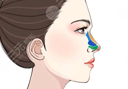 怎样让鼻子变挺?
