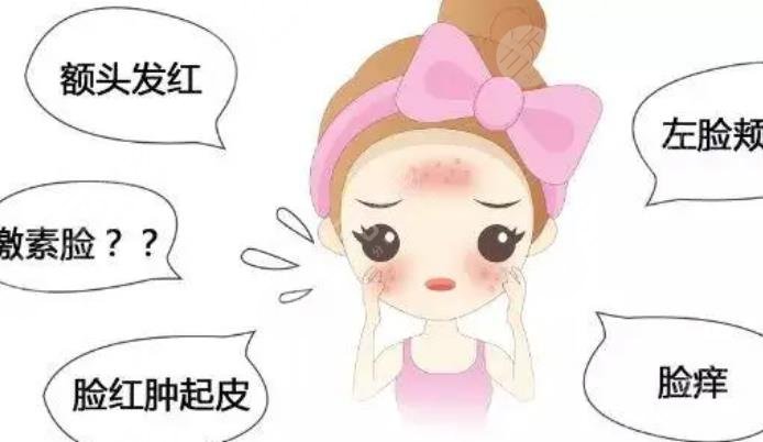 敏感肌