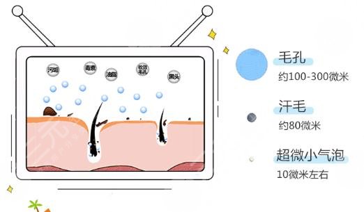 超微小气泡