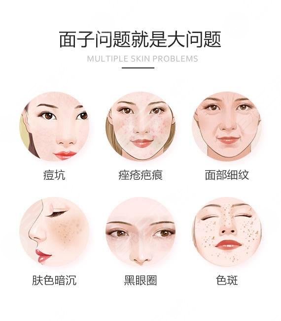 脸上有痘坑有什么办法可以恢复??
