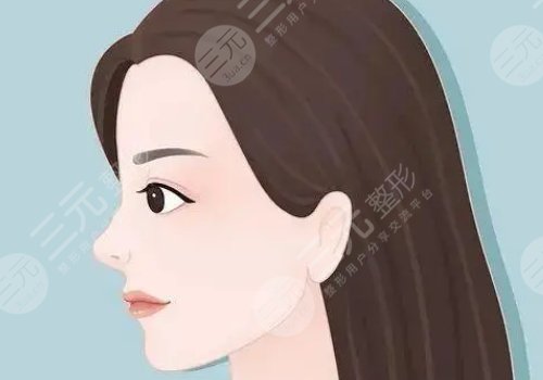 耳软骨隆鼻修复假体还能用吗?