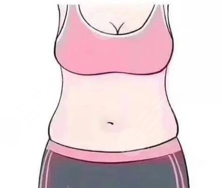 水桶腰
