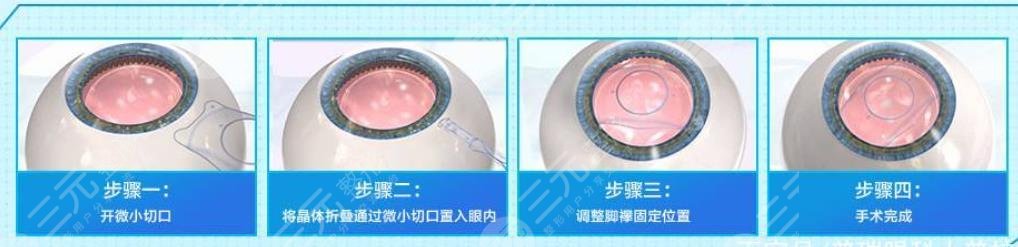 近视眼
