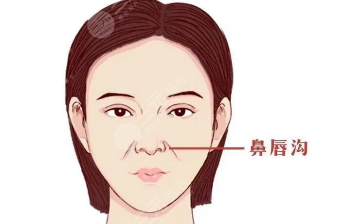 去鼻唇自体脂肪填充和热玛吉哪个好?