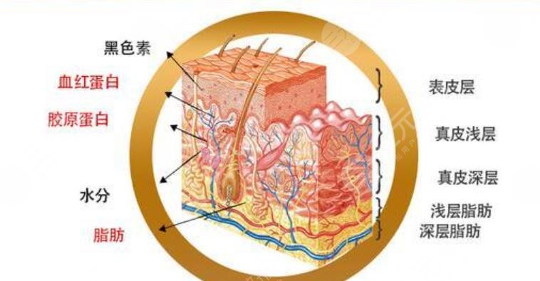 像束激光除皱