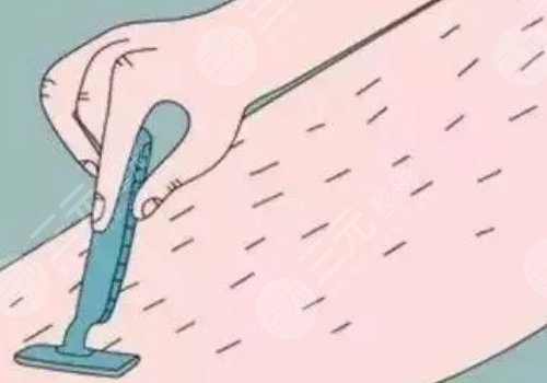 男士激光脱毛果如何?
