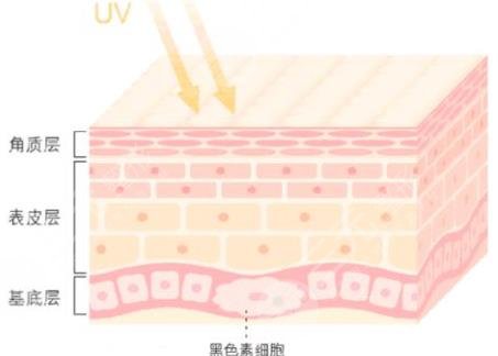 果酸换肤
