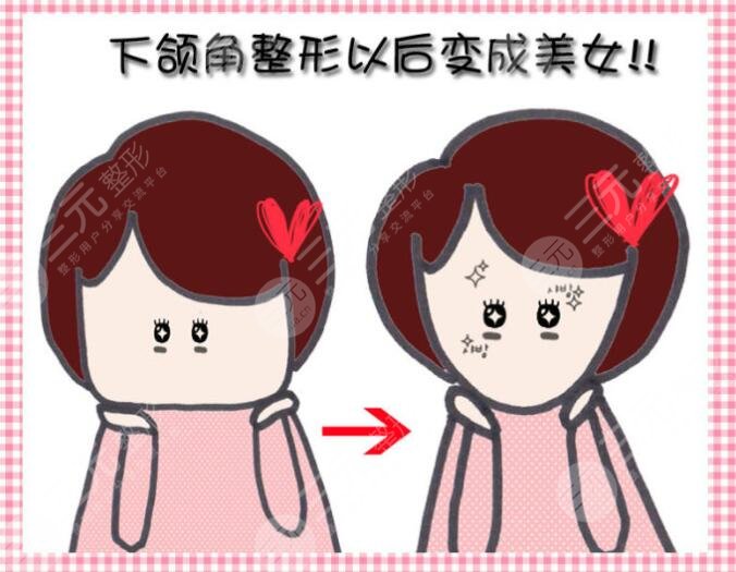 磨骨瘦脸术后的注意事项