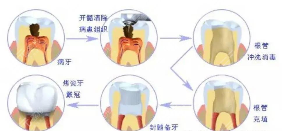 生姜或者是大蒜