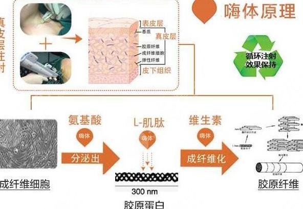 嗨体去颈纹