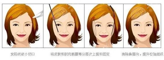皱纹是怎么形成的?