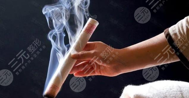 艾灸