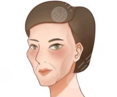 面部凹陷