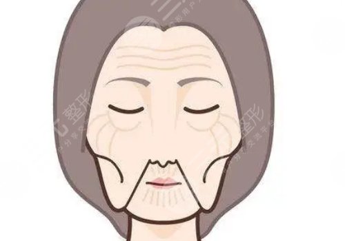 去法令纹的小窍门