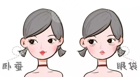 怎样去除眼袋皱纹