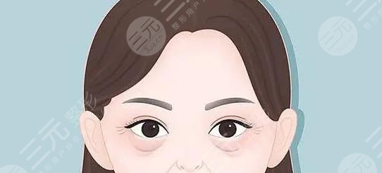 眼角有细纹怎么办