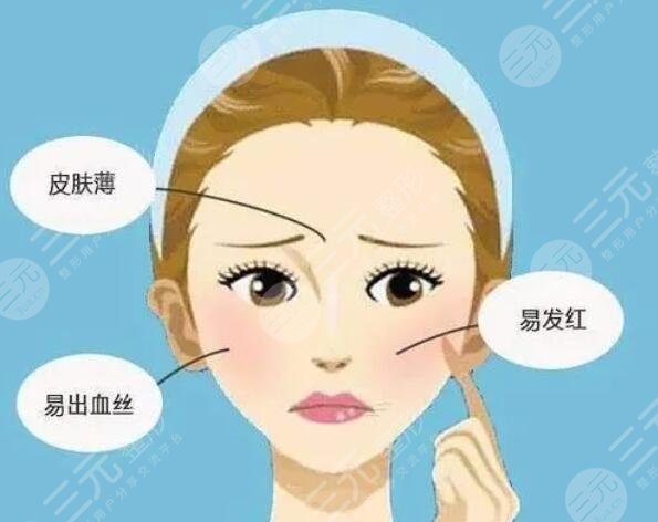 冰敷
