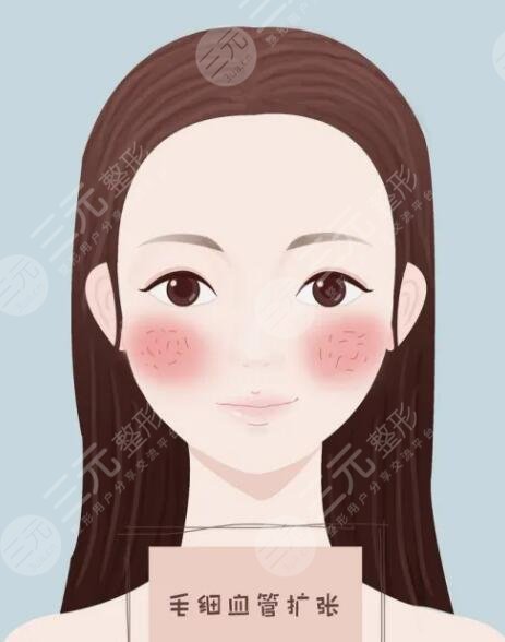 选择合适的护肤品