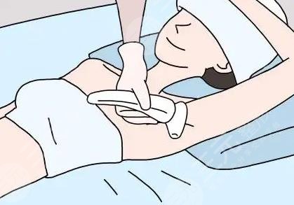 手臂激光脱毛多少钱
