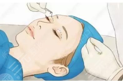 眼部保养